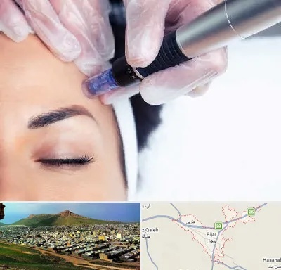 کلینیک مزوتراپی صورت در بیجار