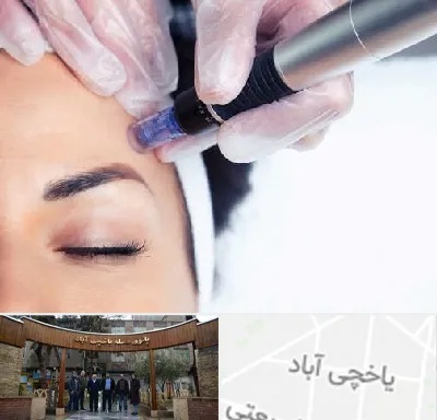کلینیک مزوتراپی صورت در یاخچی آباد