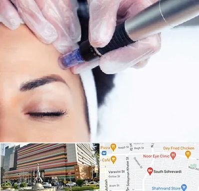 کلینیک مزوتراپی صورت در سهروردی 