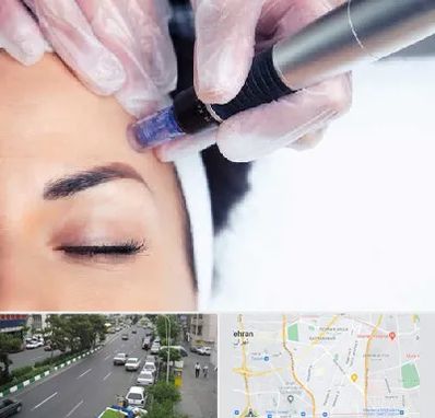 کلینیک مزوتراپی صورت در ستارخان 