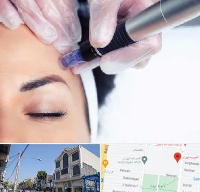 کلینیک مزوتراپی صورت در افسریه 