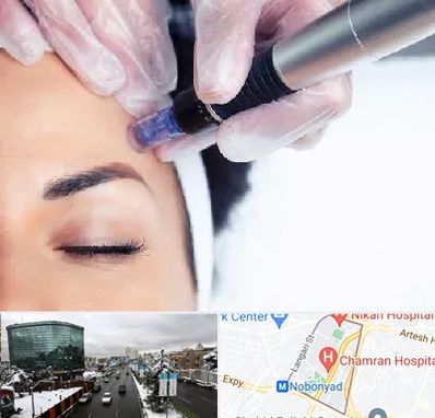 کلینیک مزوتراپی صورت در اقدسیه 