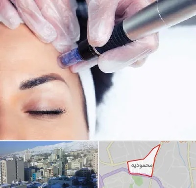 کلینیک مزوتراپی صورت در محمودیه