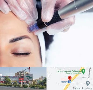 کلینیک مزوتراپی صورت در هروی 