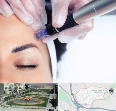 کلینیک مزوتراپی صورت در مرزداران تبریز