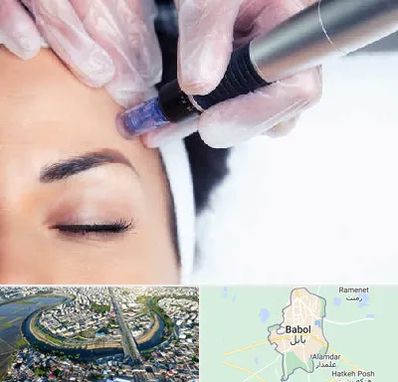 کلینیک مزوتراپی صورت در بابل