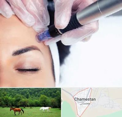 کلینیک مزوتراپی صورت در چمستان