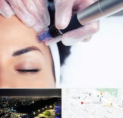 کلینیک مزوتراپی صورت در هفت تیر مشهد