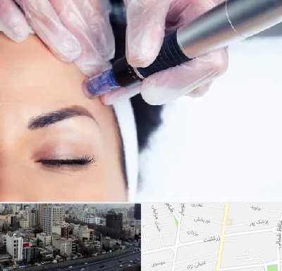 کلینیک مزوتراپی صورت در زرتشت