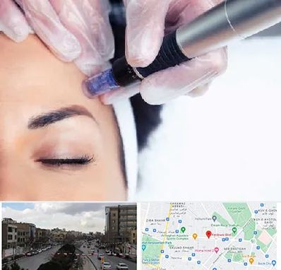 کلینیک مزوتراپی صورت در بلوار فردوسی مشهد