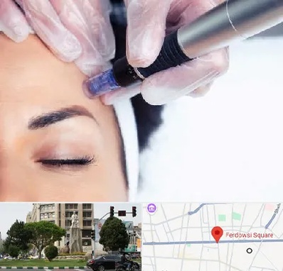 کلینیک مزوتراپی صورت در میدان فردوسی تهران