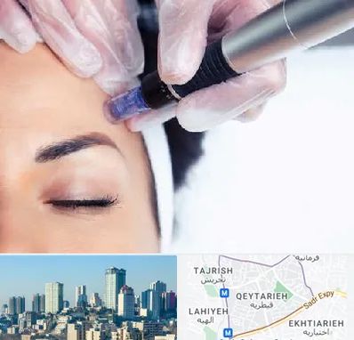 کلینیک مزوتراپی صورت در قیطریه 