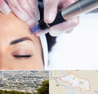 کلینیک مزوتراپی صورت در یاسوج