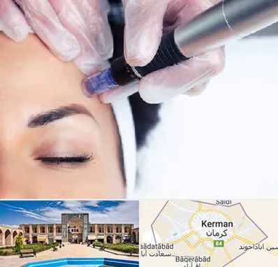 کلینیک مزوتراپی صورت در کرمان