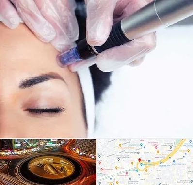 کلینیک مزوتراپی صورت در میدان ولیعصر 