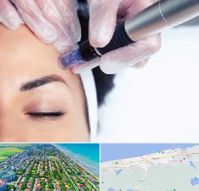 کلینیک مزوتراپی صورت در فریدونکنار