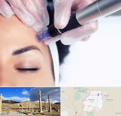 کلینیک مزوتراپی صورت در مرودشت