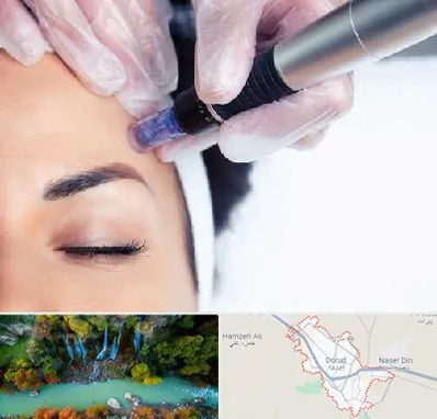 کلینیک مزوتراپی صورت در دورود