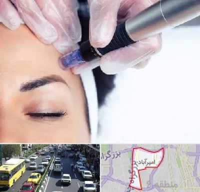 کلینیک مزوتراپی صورت در امیرآباد