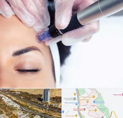 کلینیک مزوتراپی صورت در خیابان نیایش شیراز