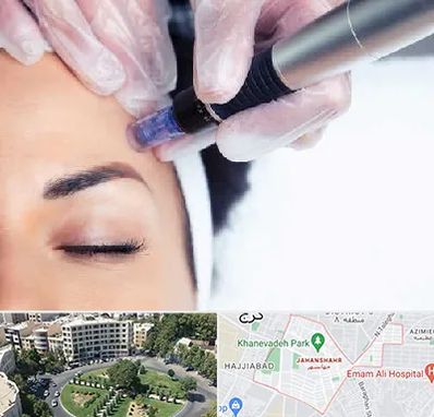 کلینیک مزوتراپی صورت در جهانشهر کرج 