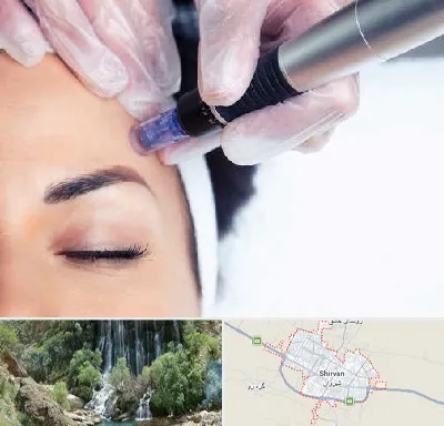 کلینیک مزوتراپی صورت در شیروان