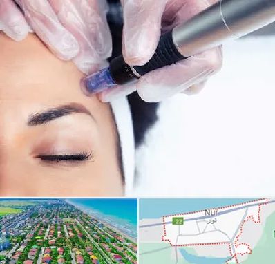 کلینیک مزوتراپی صورت در نور