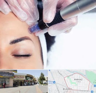 کلینیک مزوتراپی صورت در پرواز تبریز