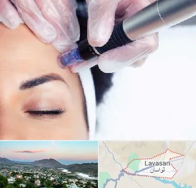 کلینیک مزوتراپی صورت در لواسان