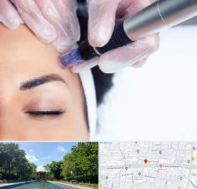 کلینیک مزوتراپی صورت در هشت بهشت اصفهان