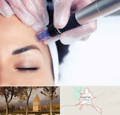 کلینیک مزوتراپی صورت در تویسرکان