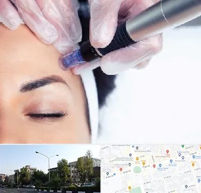 کلینیک مزوتراپی صورت در میدان کاج 