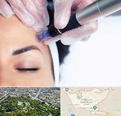 کلینیک مزوتراپی صورت در شهرکرد