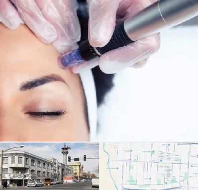 کلینیک مزوتراپی صورت در 17شهریور