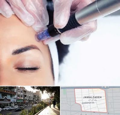 کلینیک مزوتراپی صورت در خیابان جمالزاده