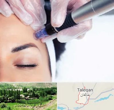 کلینیک مزوتراپی صورت در طالقان