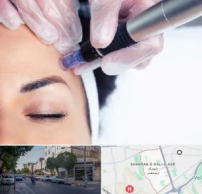 کلینیک مزوتراپی صورت در شهرک ولیعصر