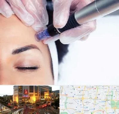 کلینیک مزوتراپی صورت در جنت آباد تهران 