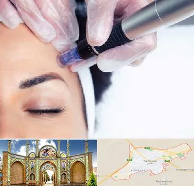 کلینیک مزوتراپی صورت در سمنان