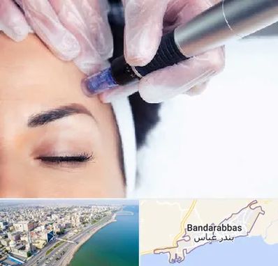 کلینیک مزوتراپی صورت در بندرعباس