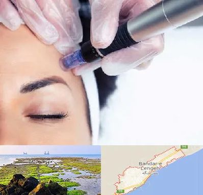 کلینیک مزوتراپی صورت در بندرلنگه