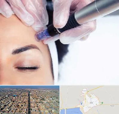 کلینیک مزوتراپی صورت در بندر ماهشهر