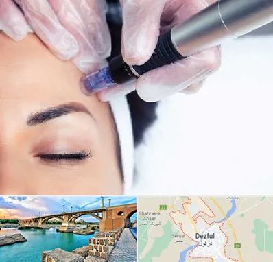 کلینیک مزوتراپی صورت در دزفول