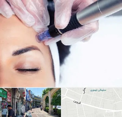 کلینیک مزوتراپی صورت در خیابان قزوین