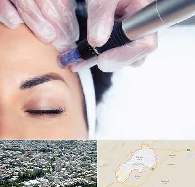 کلینیک مزوتراپی صورت در شاهرود