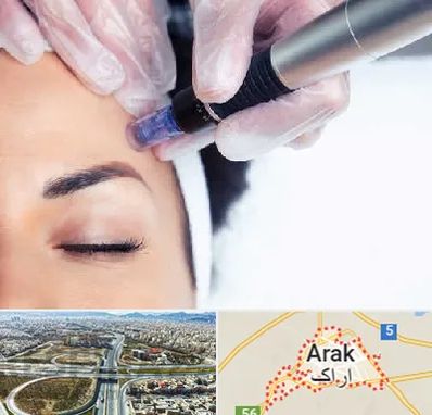 کلینیک مزوتراپی صورت در اراک