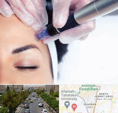 کلینیک مزوتراپی صورت در شهران 