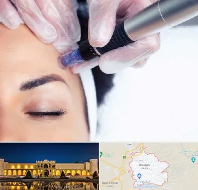 کلینیک مزوتراپی صورت در برازجان