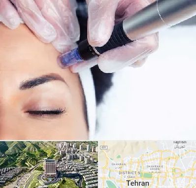 کلینیک مزوتراپی صورت در شمال تهران 