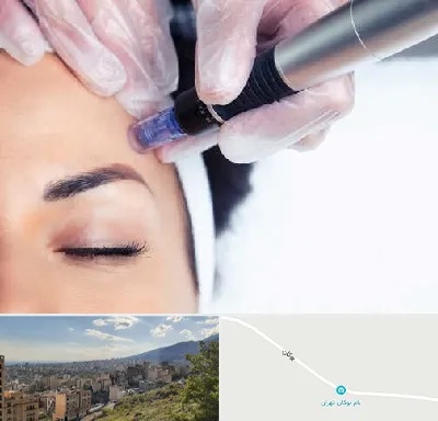 کلینیک مزوتراپی صورت در بوکان تهران